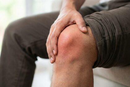 What is inflammatory arthritis?