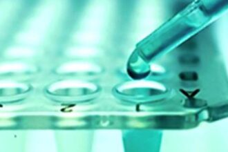 Why finding compatible stem cells remains a major challenge for patients with aplastic anemia