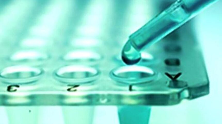 Why finding compatible stem cells remains a major challenge for patients with aplastic anemia