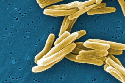 Study identifies new mechanism to detect and weaken Mycobacterium tuberculosis