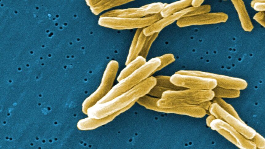 Study identifies new mechanism to detect and weaken Mycobacterium tuberculosis