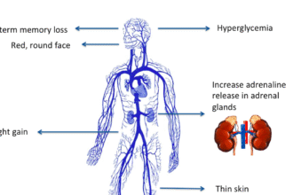 What you need to know: About Cushing's syndrome