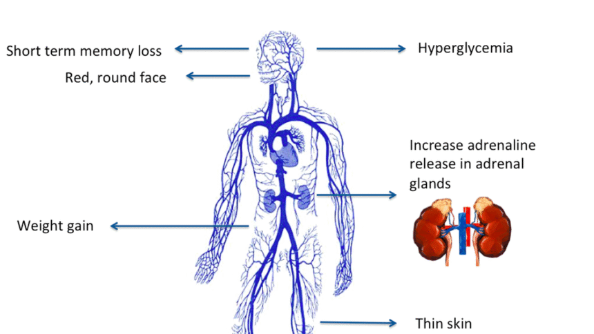 What you need to know: About Cushing's syndrome