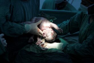 Telangana has the highest caesarean section rate in India. Nearly 6 out of 10 babies are delivered surgically