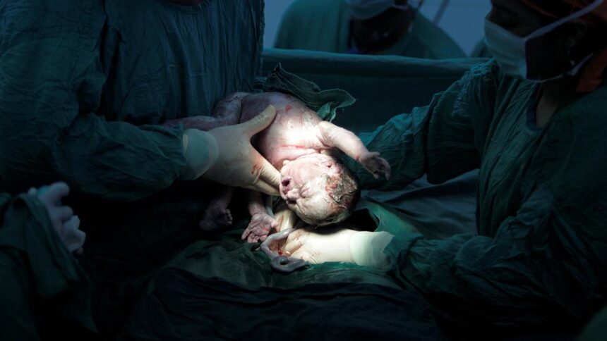 Telangana has the highest caesarean section rate in India. Nearly 6 out of 10 babies are delivered surgically