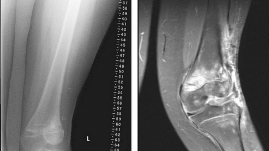 Bang in the knee in children: why it happens and when it is necessary to see a doctor