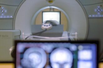 Study finds that less abdominal fat accumulation in midlife is associated with slower brain atrophy