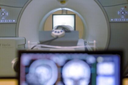 Study finds that less abdominal fat accumulation in midlife is associated with slower brain atrophy