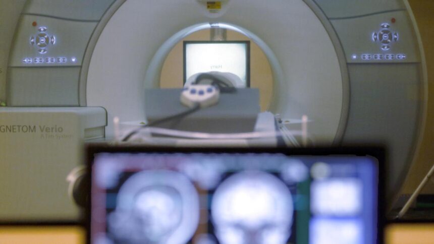 Study finds that less abdominal fat accumulation in midlife is associated with slower brain atrophy