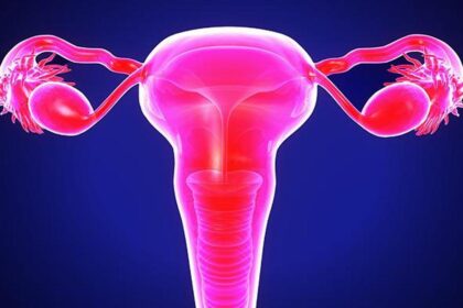 Why ovarian cancer needs a loud voice