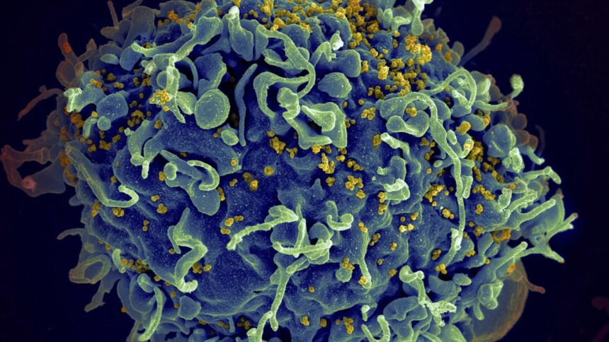 Small study suggests activating immune cells may help fight HIV