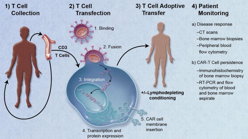 Understanding the potential of CAR-T therapy in treating autoimmune diseases