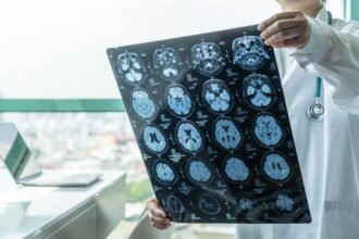 World Health Assembly recognizes stroke as a public health priority for the first time