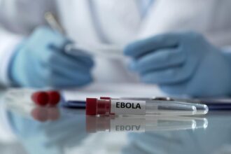 Center for close monitoring of the Ebola situation in Central Africa: Ministry of Health