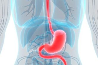 Avoiding the risk of stomach cancer in women and early detection