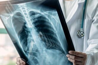 Can lung cancer be prevented with drugs?