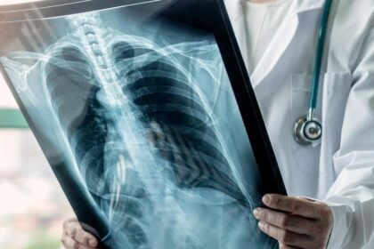 Can lung cancer be prevented with drugs?