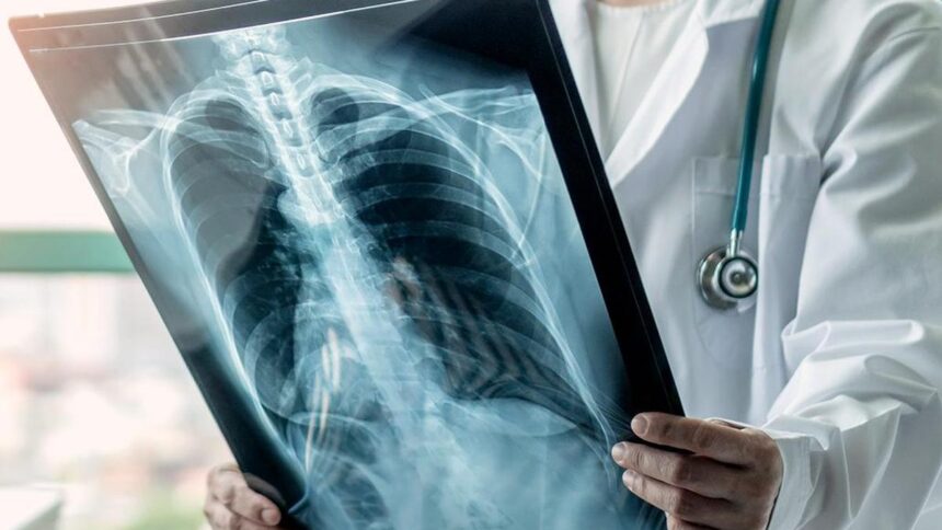 Can lung cancer be prevented with drugs?