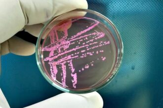 Shigella | Toxic bacteria