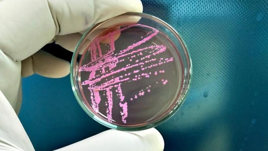 Shigella | Toxic bacteria