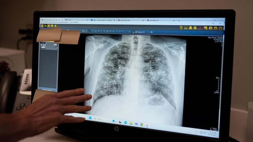 Lung cancer: Scans for early detection and preventive injections