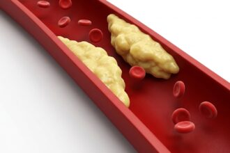 Lifestyle habits that may help lower LDL cholesterol naturally