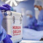 The center requests hospitals to disclose survival data after organ transplants