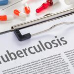 India needs innovative strategies to eliminate tuberculosis