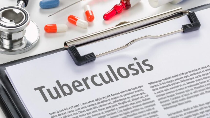 India needs innovative strategies to eliminate tuberculosis