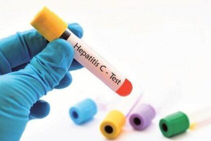 Everything you need to know about hepatitis C