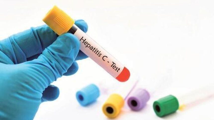 Everything you need to know about hepatitis C