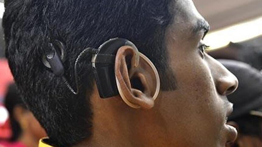 Beyond childhood: Expanding the potential of cochlear implants for hearing restoration