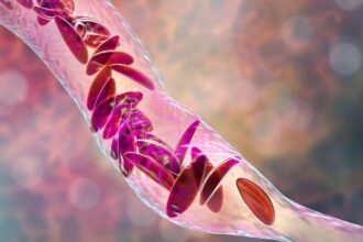 Experts emphasize early diagnosis of anemia and identification of root causes