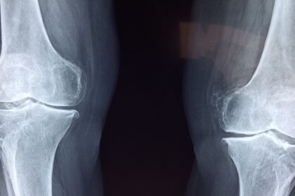 Doctor explains weather-related joint pain