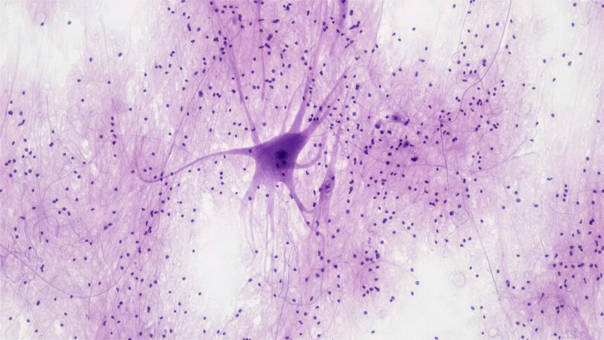 Are new neurons born in the adult human brain? Research revives debate