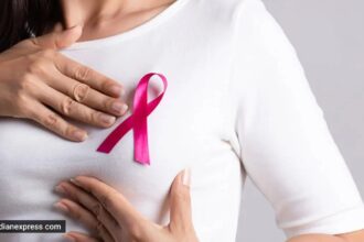 breast cancer
