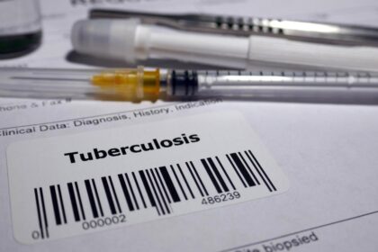 Reconstitution of the immune system by tuberculosis vaccine may explain association with lower risk of Alzheimer's disease: study