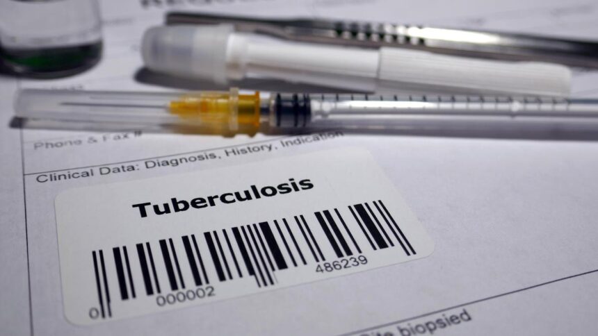Reconstitution of the immune system by tuberculosis vaccine may explain association with lower risk of Alzheimer's disease: study
