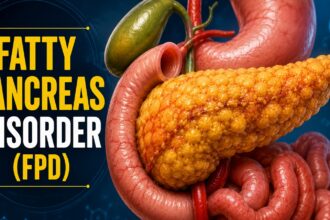 fatty pancreas disorder